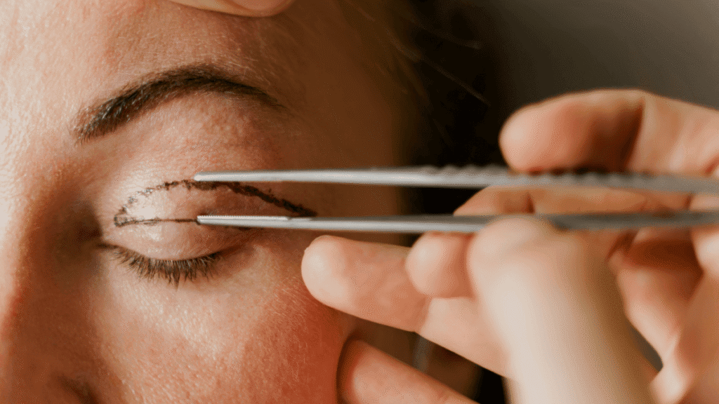 blefaroplastia
dra Rafaela Marques
ribeirão preto