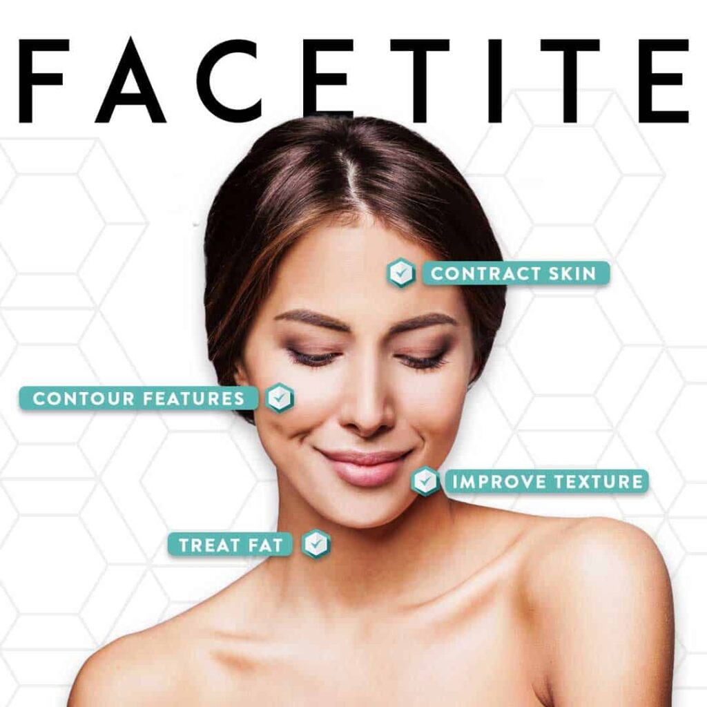 facetite