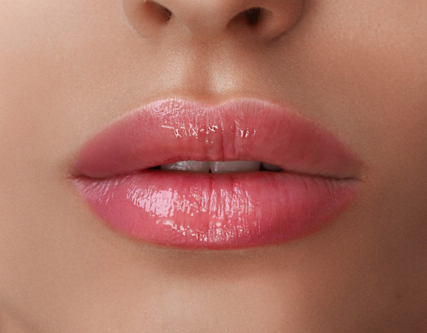 lip lift