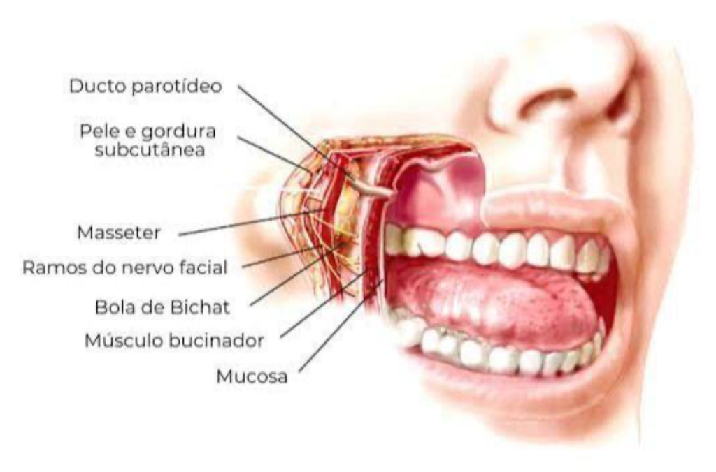 bichectomia